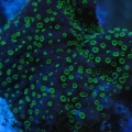 montiUndataActinics